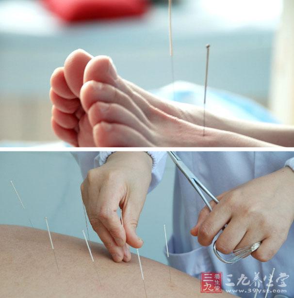 扎针_扎针减肥_扎针的拼音